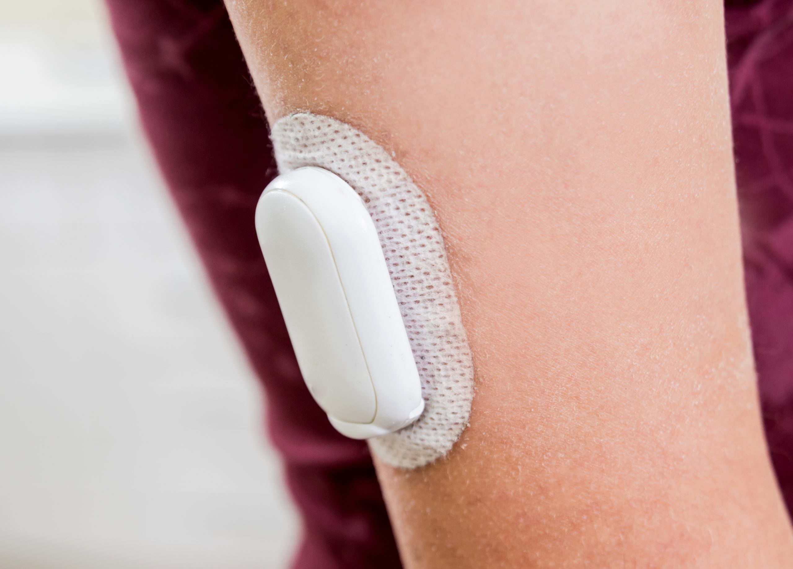 Device Assisted Drug Delivery